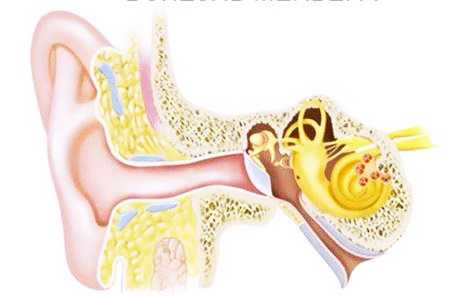 Краткое описание болезни
