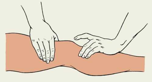 Лечение гемартроза