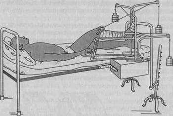 Процесс реабилитации